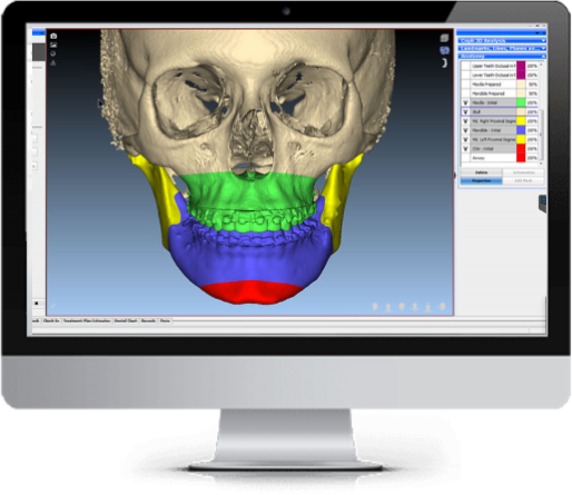 3D Digitale orthognathische Planung